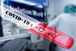 Covid-19 test